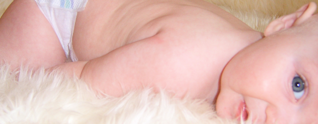 Hidrocefalia neonatală Hidrocefalia neonatală