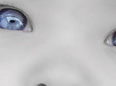 Hidrocefalia fetală Hidrocefalia fetală