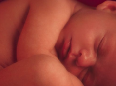 Hidrocefalia sugarului Hidrocefalia sugarului