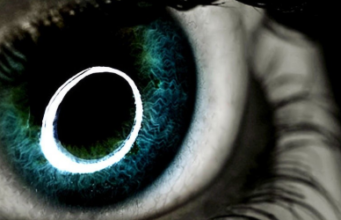 Examenul fundului de ochi Examenul fundului de ochi