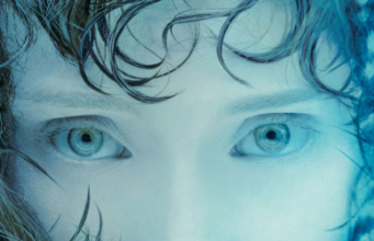 Sindromul TURNER Sindromul TURNER