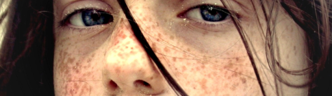 Sindromul X fragil Sindromul X fragil