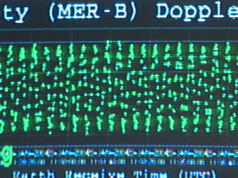 Investigatia DOPLER Ecografia DOPLER