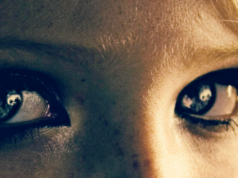 Vertij paroxistic benign vertij paroxistic benign