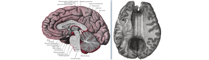 Agenezia de corp calos Corp Calos - sectiune