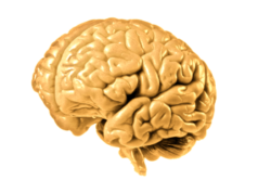 Holoprozencefalia Holoprozencefalia