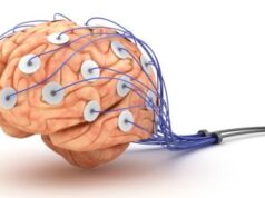 EEG – înregistrarea activității electrice a creierului Electroencefalograma - EEG