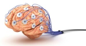EEG – înregistrarea activității electrice a creierului Electroencefalograma - EEG