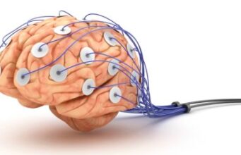 EEG – înregistrarea activității electrice a creierului Electroencefalograma - EEG