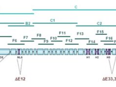 Sindromul Cornelia de Lange Sindrom-Cornelia-de-Lange