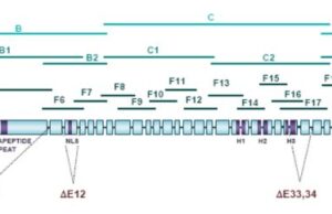 Sindromul Cornelia de Lange Sindrom-Cornelia-de-Lange