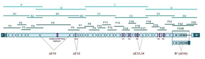Sindromul Cornelia de Lange Sindrom-Cornelia-de-Lange