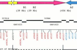 Sindrom de deleție 18q Sindrom de deletie 18q