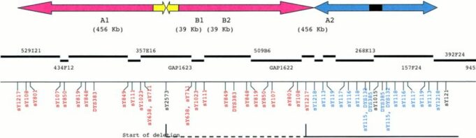 Sindrom de deleție 18q Sindrom de deletie 18q
