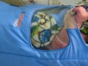 Hipotermia Hipotermia