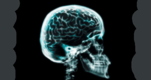 Radiografia craniană Radiografia craniana