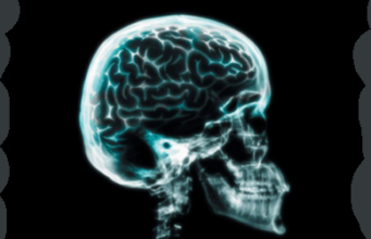 Radiografia craniană Radiografia craniana