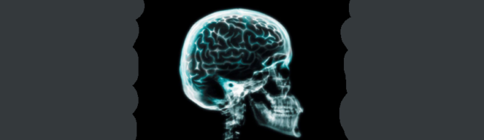 Radiografia craniană Radiografia craniana