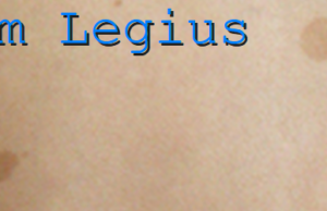 Sindromul Legius și asemănarea cu Neurofibromatoza tip 1 Sindrom Legius