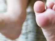 Sindromul picioarelor neliniștite Sindromul picioarelor nelinistite