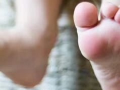 Sindromul picioarelor neliniștite Sindromul picioarelor nelinistite