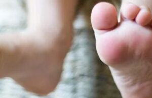 Sindromul picioarelor neliniștite Sindromul picioarelor nelinistite