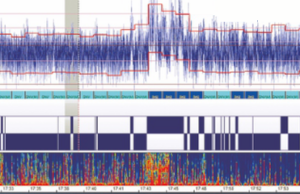 EEG de amplitudine integrată, aEEG aEEG